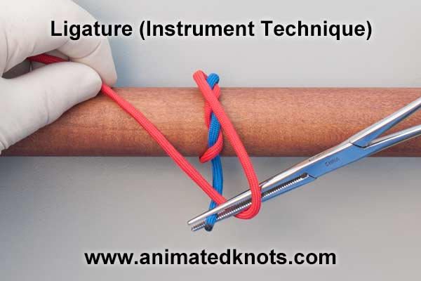 ligature_instrument_technique.jpg