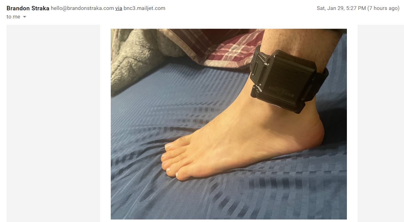 Brandon Ankle.JPG