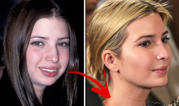 Ivanka-Trump-plastic-surgery-side-view-810568.jpg